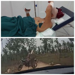 Lagi - Lagi Wartawan Jadi Korban Pembacokan Oknum Preman Kapolda Jatim Segera Usut Tuntas