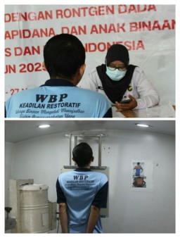 Lapas Kelas IIA Sidoarjo Gelar Screening Kesehatan dan Pemeriksaan X-Ray untuk Pencegahan TBC Warga Binaan