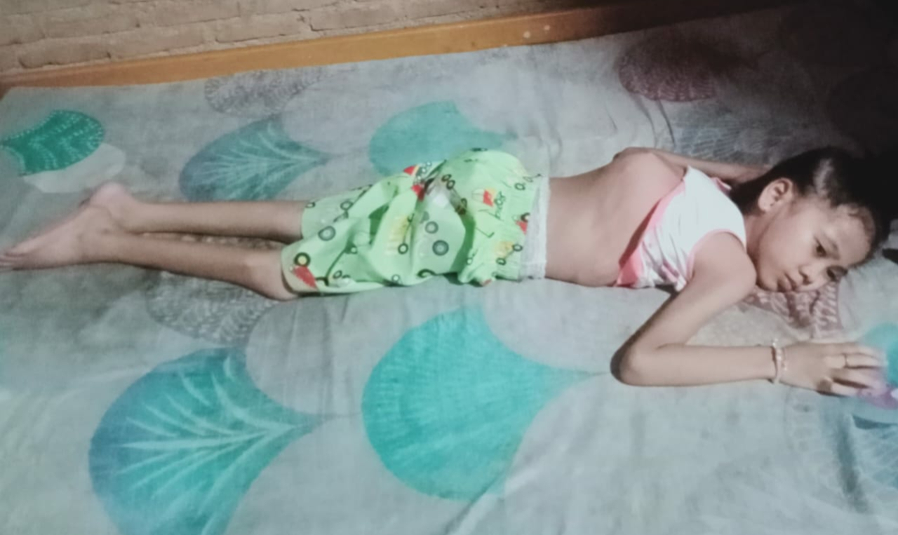 10 Bulan Risma Terbaring Lemah, Orang Tuanya Hanya Bisa Menangis dan Memohon Uluran Tangan Bupati Tanggamus