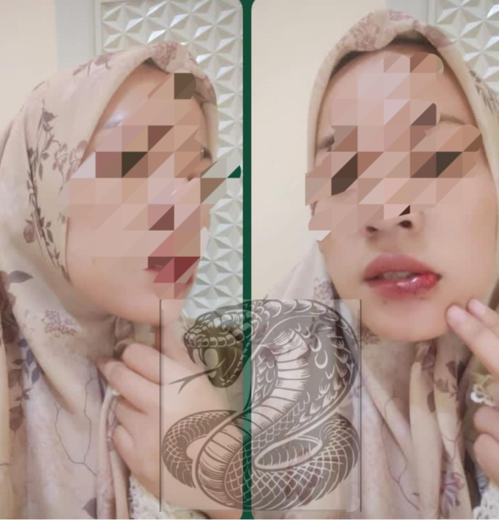 Kekerasan dan Stigma: Inisial HH Bersuara